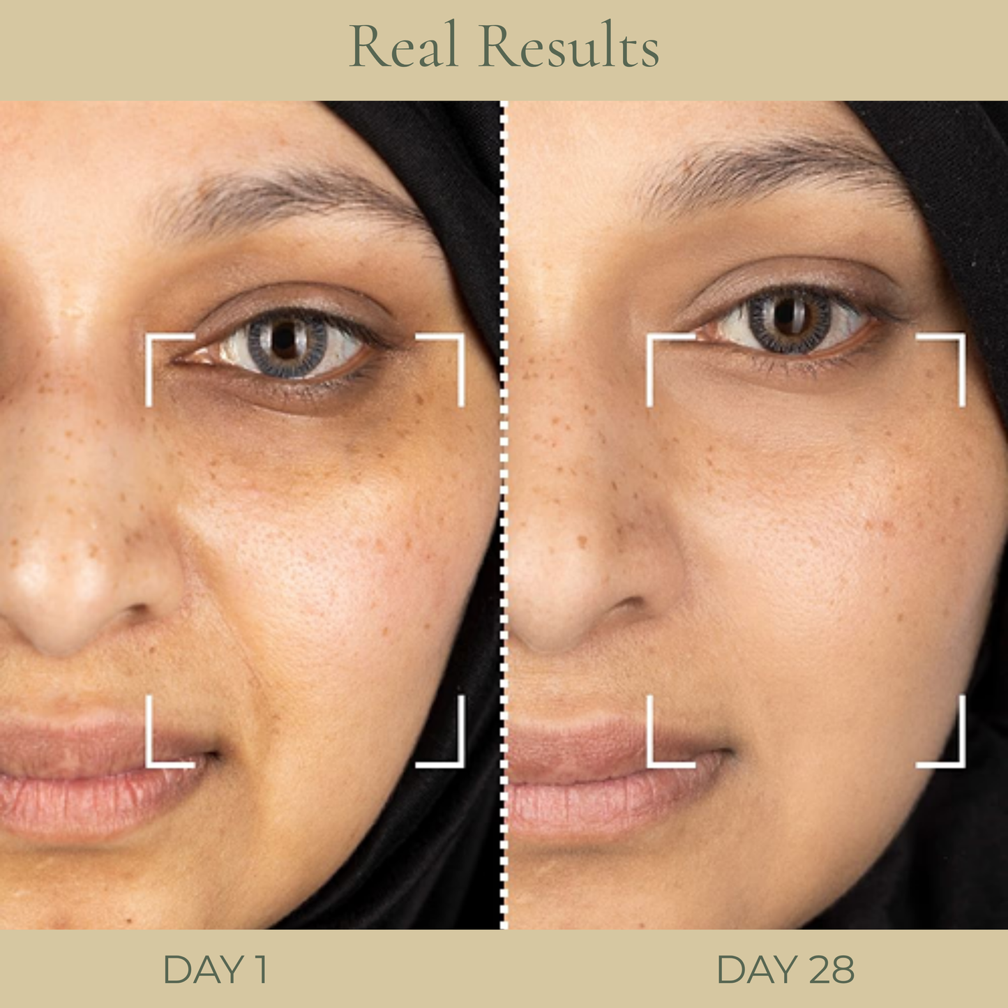 Collagen Care Set