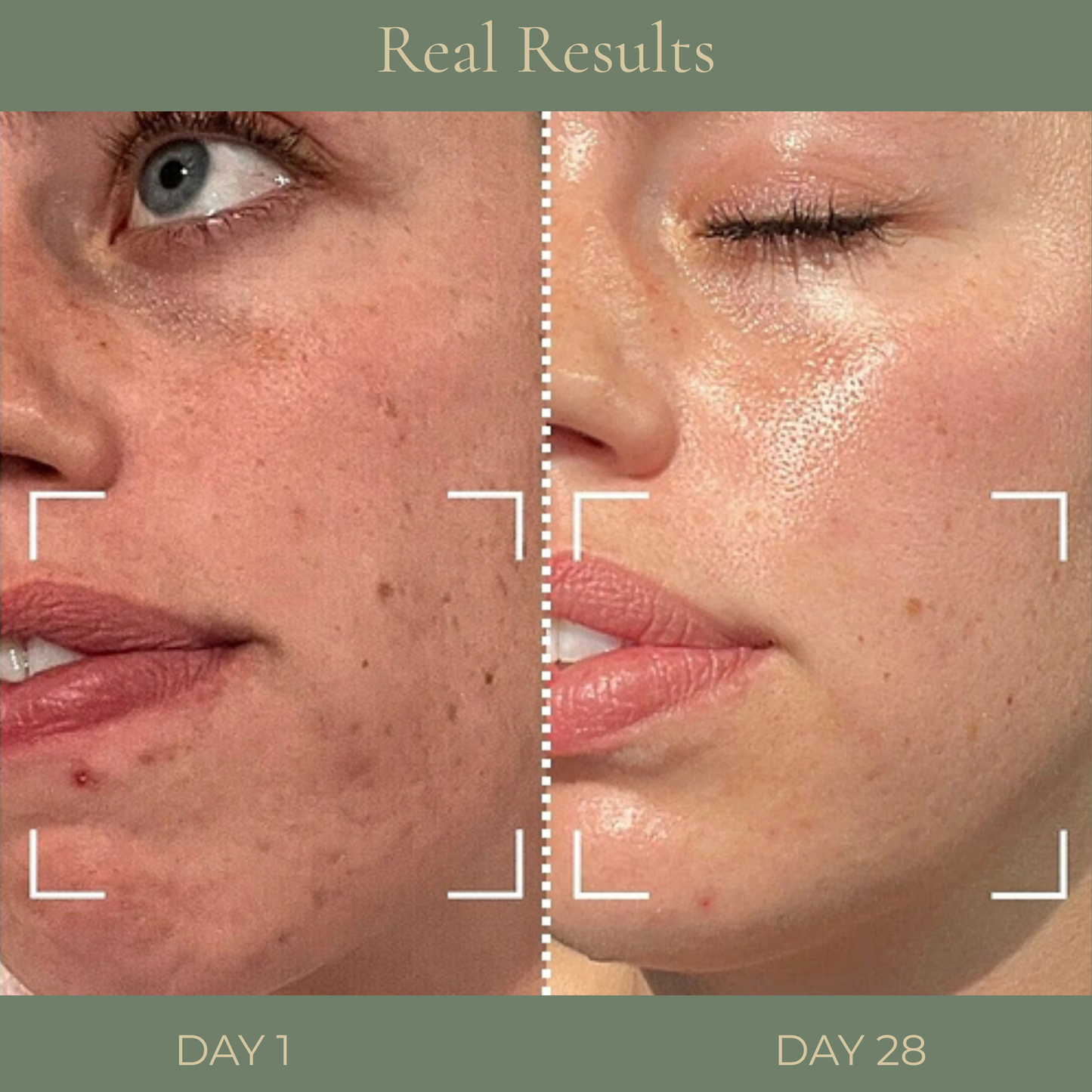 Ceramide Repair Kit