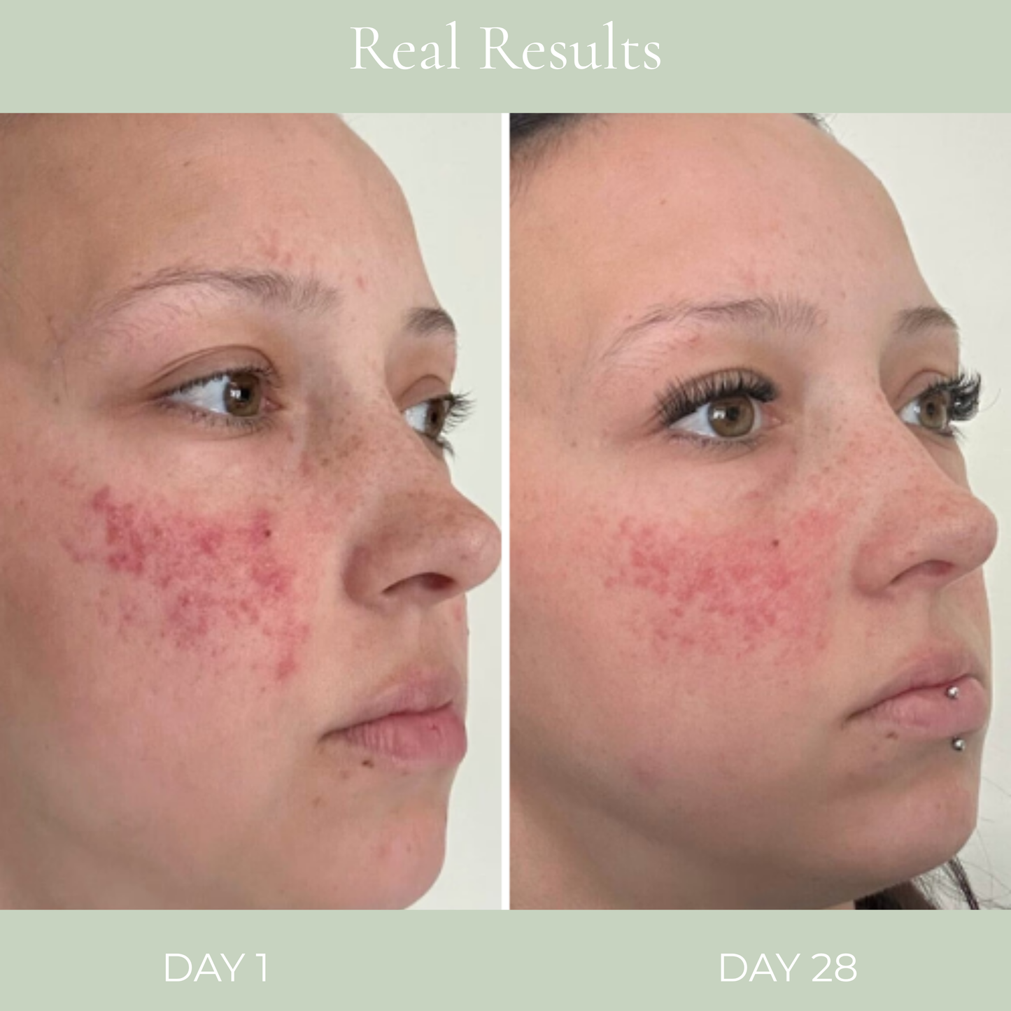 DermaPulse™