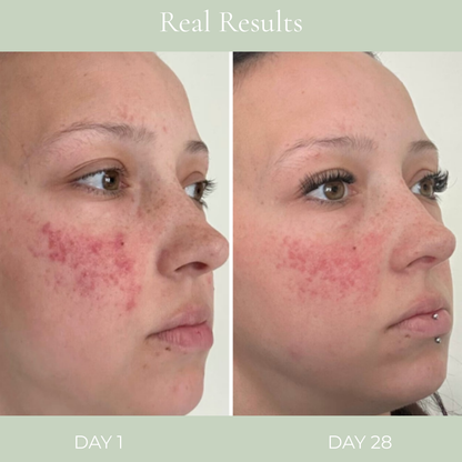 DermaPulse™