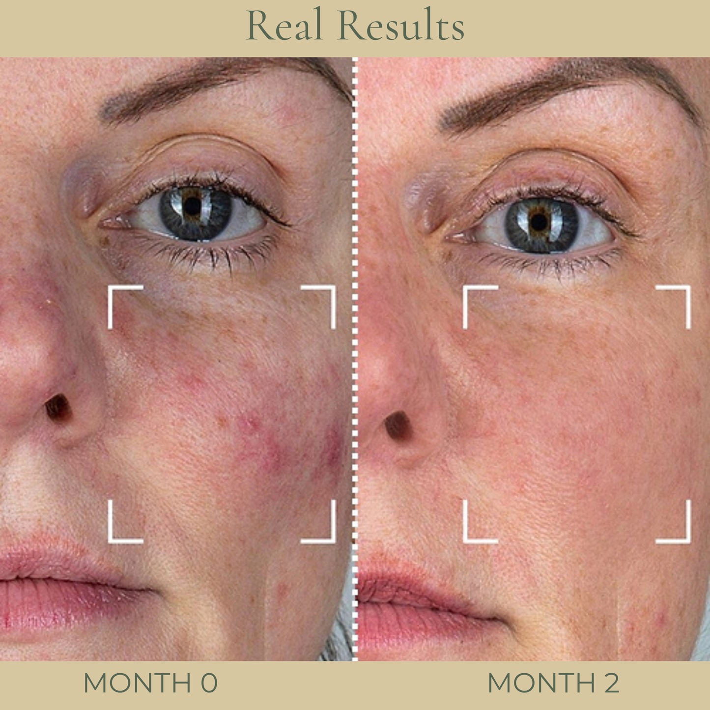 Vitamin C Glow Kit