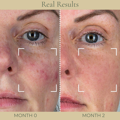Vitamin C Glow Kit